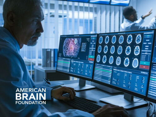 Supporting brain disease research through funding