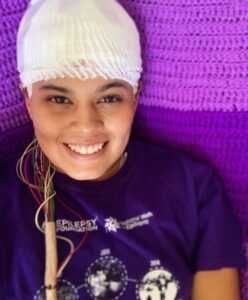 Sasha Pine after her VNS implant surgery for epilepsy