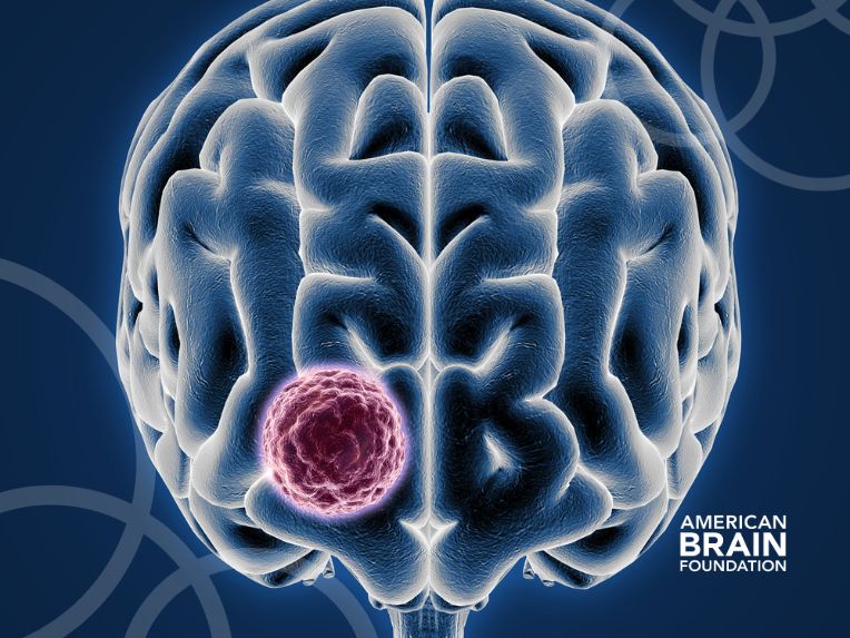 Traumatic Brain Injury - American Brain Foundation