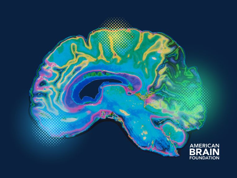New Alzheimers Treatment Two Existing Drugs Reverse Brain Damage In Mice - op17jro