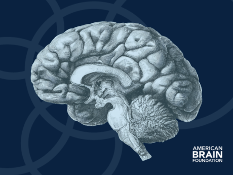 Adult-Onset Leukoencephalopathy With Axonal Spheroids and Pigmented ...
